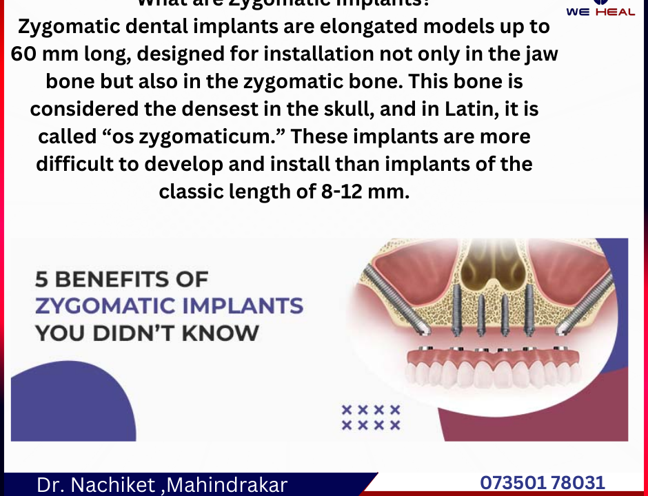 Dr. Sneha Mahindrakar| Best Dental Care and Implant Center in Baner.