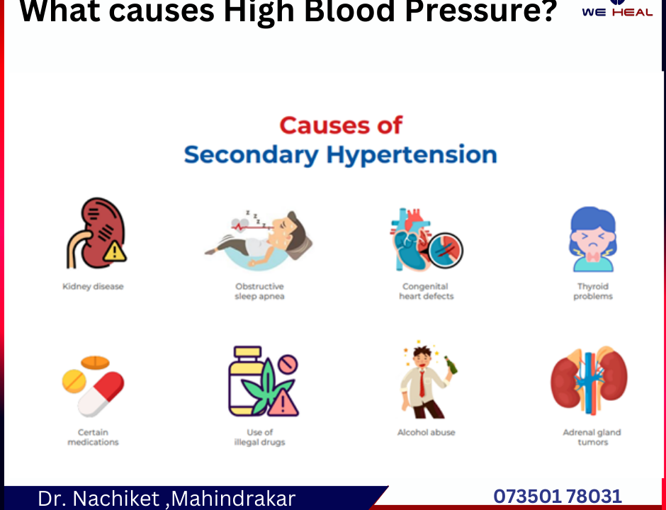 Dr. Nachiket Mahindrakar, renowned cardiologist specializing in blood pressure and hypertension. Get expert care for optimal heart health.