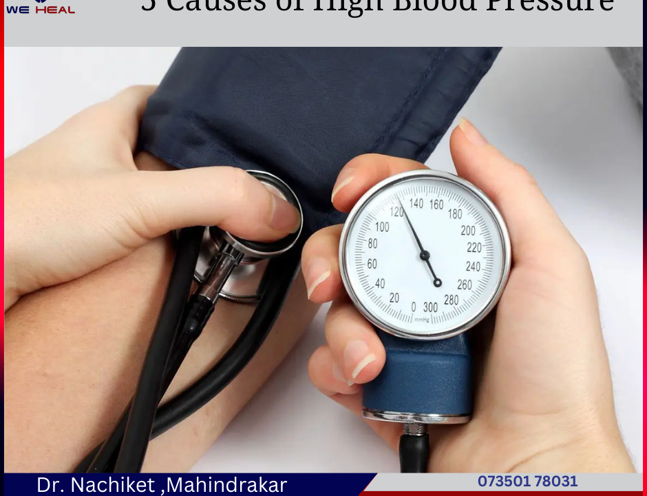 Best Doctors for Blood Pressure| Heart specialist | in Baner