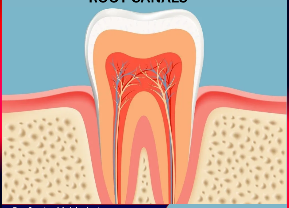 Root Canal Specialist in Baner