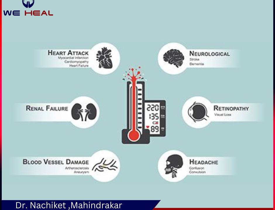 High Blood Pressure specilaist in baner