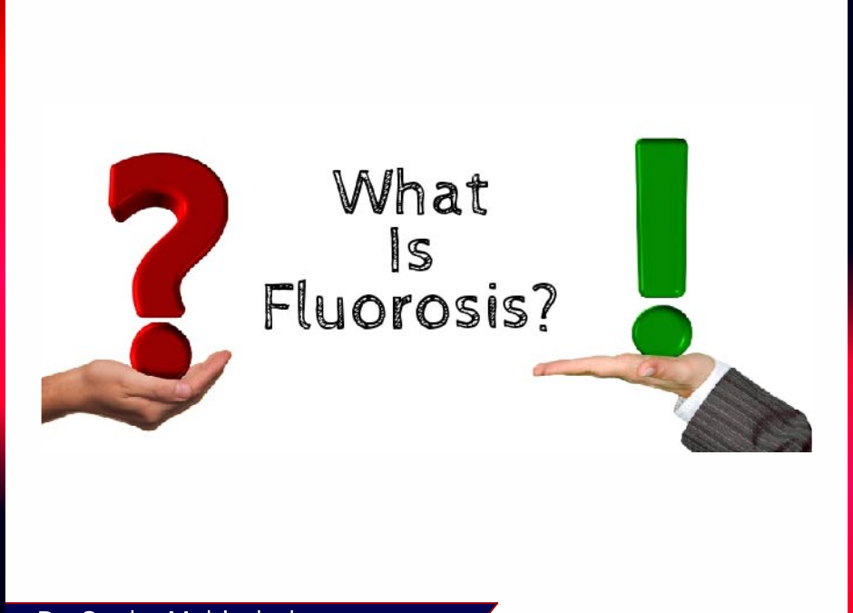 Dental Fluorosis