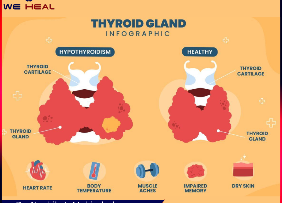 Thyroid Treatment in pune