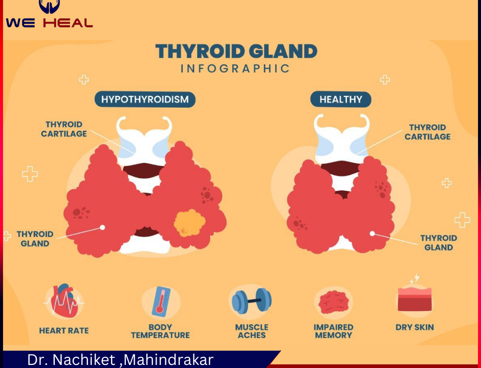 Thyroid Treatment in pune