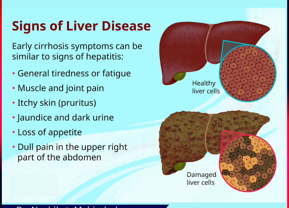 Signs of Liver Disease