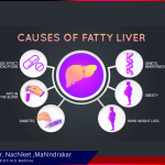 Liver Disease Treatment in pune