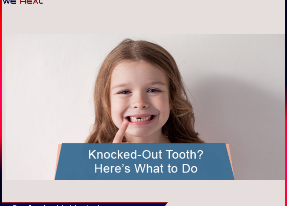 Knocked-Out Tooth