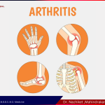 Arthritis Treatment in pune