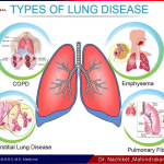 Types of Lung Disease Treatment in pune