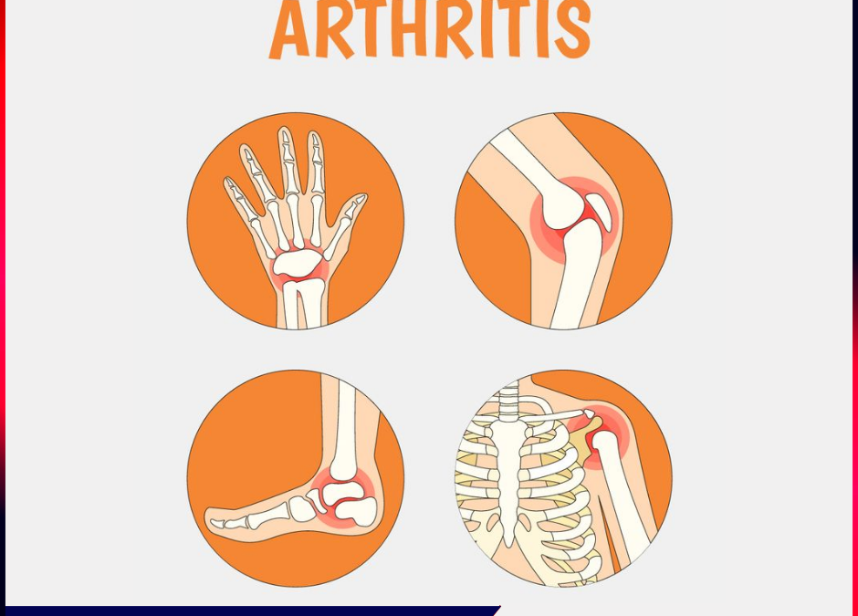 Arthritis Treatment in pune