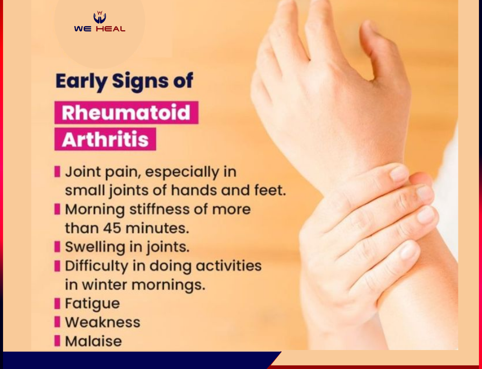 Rheumatoid Arthritis in pune