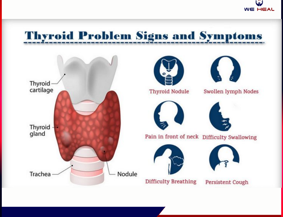 Thyroid Treatment in pune