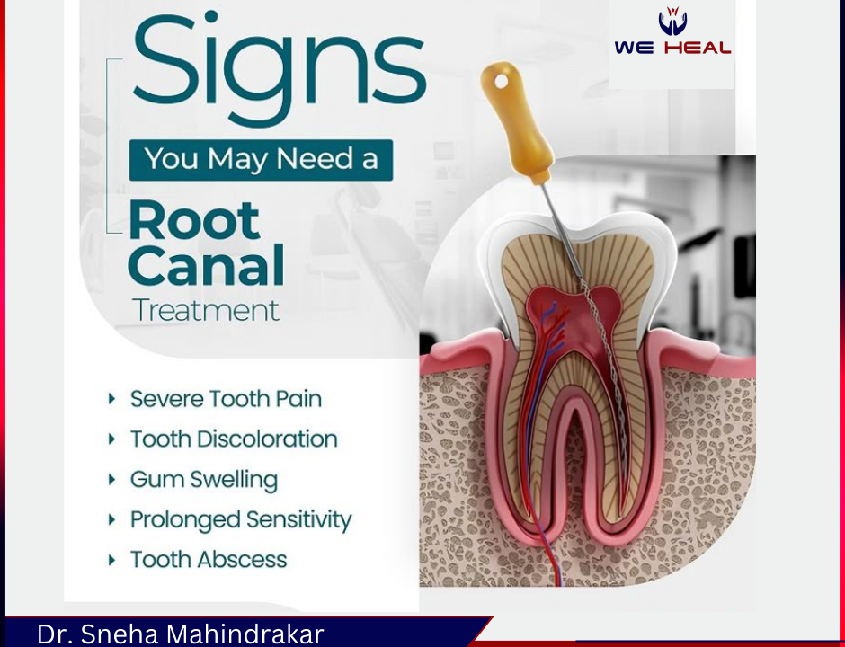 Root Canal Treatment in warje